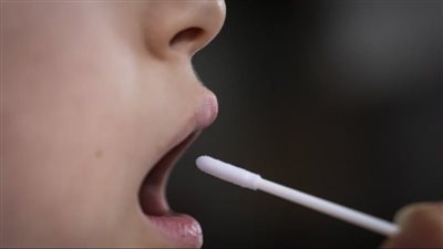 ثلثا مرضى فيروس كورونا هم من النساء | دراسة