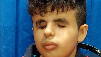 ثقافة بورسعيد تحتفل باليوم العالمي للعصا البيضاء للمكفوفين