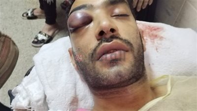 ضربه بشاكوش في ليلة الدخلة.. وفاة شاب تعدى عليه طليق زوجته بالمحلة 