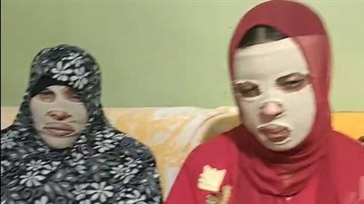 فتاة قليوب ضحية تشويه وجهها على يد عاطل رفضت خطبته: مش قضيتي لوحدي ولازم يتم وضع حد | بث مباشر 