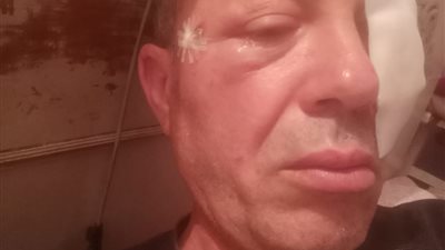 استكمل الرحلة وهو ينزف.. إصابة قائد قطار طنطا بعد رشقه بالحجارة 