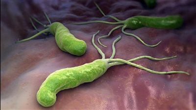 الصحة الأمريكية تصدر تنبيهًا خطيرًا بسبب ارتفاع حالات الإصابة بجرثومة المعدة 