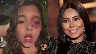 ابنة شيرين عبد الوهاب تكشف حقيقة تعرضها للضرب 