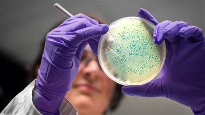 بسبب اللحوم والجبن الملوث.. تفشي مرض الليستريا في الولايات المتحدة الأمريكية