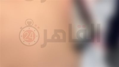دخل في صدره سيخ وخرج الناحية التانية.. إنقاذ حياة عامل بناء بقصر العيني بعد جراحة دقيقة