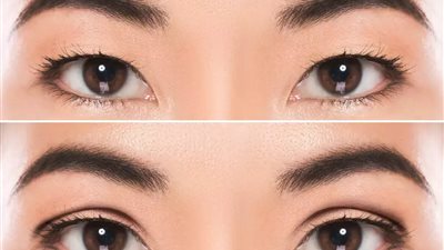 أصرت والدتها أن تكون جميلة.. طفلة 9 سنوات تخضع لعملية تجميل