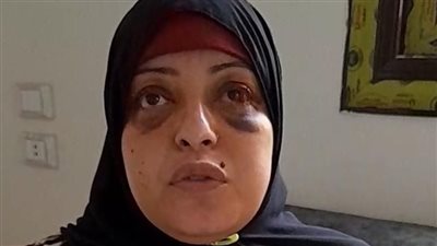  خدني في طريق مقطوع وقالي هموتك.. زوجة من ذوي الهمم تستغيث من زوجها بالشرقية | بث مباشر 