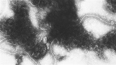 أطباء: الفيروس المخلوي التنفسي قديم وقوته أصابت الأطفال والكبار | بث مباشر 