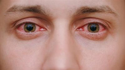 6 طرق للحفاظ على صحة العين.. تعرف عليها