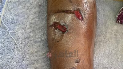 شابان يطلقان كلبا شرسا على طلاب بالغربية.. والأمن يلاحق المتهمين