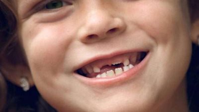 شكاوى النواب تناقش إدراج عمليات مرضى تشوه الأسنان عند الأطفال ضمن العلاج على نفقة الدولة