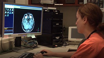 العلماء يكتشفون أسباب الصداع النصفي في دراسة حديثة