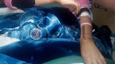 إحالة أب عذب طفلته بمعاونة زوجته للمحاكمة الجنائية بالشرقية