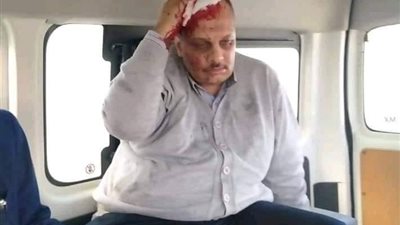 طالب جامعي يشعل النار في رئيس كنترول تجارة الإسكندرية ويطلق عليه النار (صور)