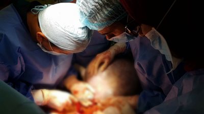 استئصال ورم من بطن مريض مسن بمعهد أورام دمنهور يزن 16 كيلو جرامًا (صور)