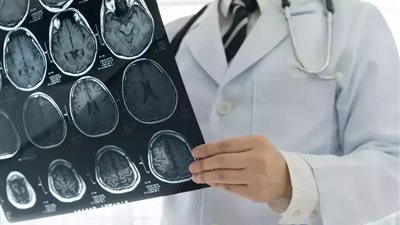 دراسة توضح العلاقة بين مكونات الدم واضطرابات الدماغ