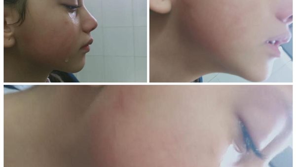 صورة الطفلة نور