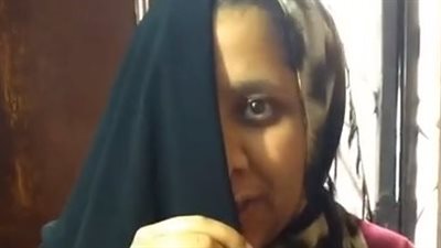 معاناة فتاة مصابة بـ عيب خلقي بوجهها: قلبي وجعني من التنمر.. وبسببه مكملتش تعليمي | بث مباشر