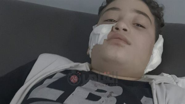 الطفل أحمد ضحية زميلة