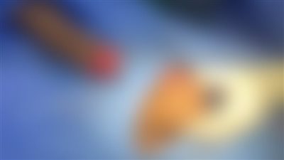 كانوا في حالة سُكر.. سودانيون يقطعون كف سائق ميكروباص بمدينة نصر | صور