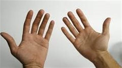 متلازمة رينود.. احذر من تلك العلامات التي تظهر على أصابعك في الشتاء 