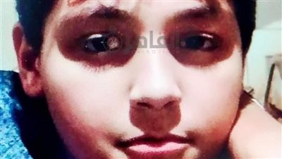 دخل يجبس دراعه خرج جثة.. تفاصيل وفاة طالب بجرعة بنج زائدة داخل مستشفى طنطا الجامعي | بث مباشر