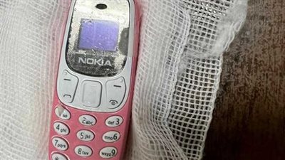 فريق طبي بمستشفى الطوارئ الجامعي بطنطا ينجح في استخراج هاتف محمول من معدة شاب | بث مباشر