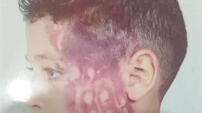 مدرس يعتدي على طالب بالصف الرابع الابتدائي بالضرب المبرح داخل مدرسة بالدقهلية