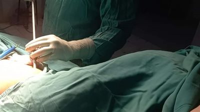 لأول مرة.. إجراء جراحة نادرة بالمنظار لمريض فشل كلوي بالإسكندرية 