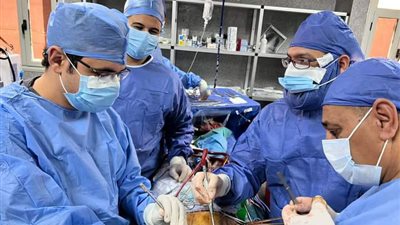 بنها الجامعي يجري أول جراحة بمنظار التجويف الصدري دون شق الصدر| صور 