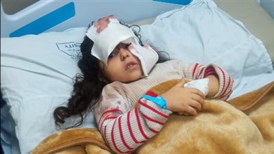 والد الطفلة المعقورة بمسطرد: عايشين وسط عشرات الكلاب وبنتي اتخيطت بـ 100 غرزة في وشها | فيديو