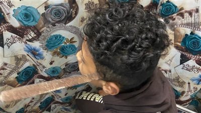 طوارئ المنصورة تستقبل طفلا اخترق مبرد رأسه