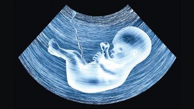 ما حكم إجهاض الجنين إذا كان في وجوده خطر على الأم؟.. دار الإفتاء توضح