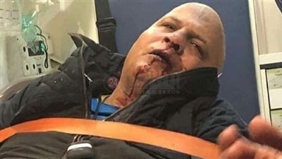 إصابة عادل شكل كبير مشجعي الثغر في سقوط مدرج مباراة الأهلي والاتحاد السكندري | صور