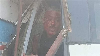 رئيس جامعة حورس: نقل 3 حالات من مصابي حادث تصادم الأتوبيس إلى مستشفى المنصورة