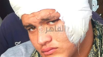 طلع اللي معاك.. القبض على بلطجي مزّق وجه طالب بالمحلة بـ 50 غرزة 