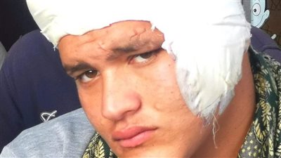 طعنه بـ كتر.. القصة الكاملة لواقعة طالب اعتدى على زميله أمام المدرسة بالغربية