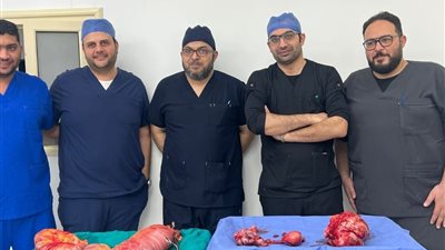 فريق طبي بمستشفى الخانكة يستأصل ورمًا وزنه 10 كيلو من مريضة