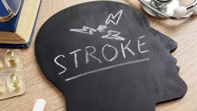 ما الذي يسبب حالات السكتة الدماغية بين الشباب؟.. تعرف على عوامل الإصابة 