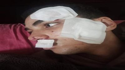 والد الطالب المعتدى عليه بأسلحة بيضاء بشبرا: ابني أصيب بـ 25 غرزة.. وأناشد بضبط الجناة