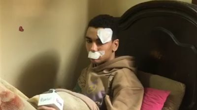 الطالب المعتدى عليه بأسلحة بيضاء بشبرا الخيمة: الجناة كتفوني وسرقوا هاتفي