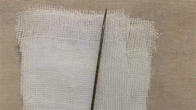 كان يحاول تسليكه.. استخراج إبرة من العضو الذكري لمريض يعاني من انسداد بولي في البحيرة 