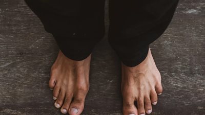 علامات تظهر على القدم تدل على وجود مشكلات في الكبد.. تعرف عليها