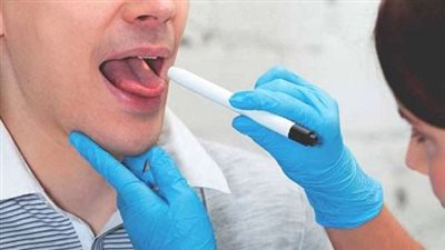 عن طريق اللعاب.. تطوير جهاز جديد للكشف عن سرطان الفم