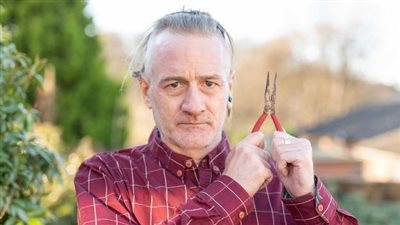 استخدم زرادية منزلية.. مصور بريطاني يخلع 5 أسنان لنفسه