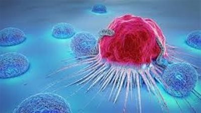 4 نصائح للوقاية من الإصابة بالسرطانات المختلفة.. تعرف عليها