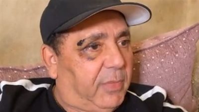 زوج علا غانم: ضربتني بالزجاج في جبهتي.. ووالدتها عملتلي جرح قطعي في دراعي