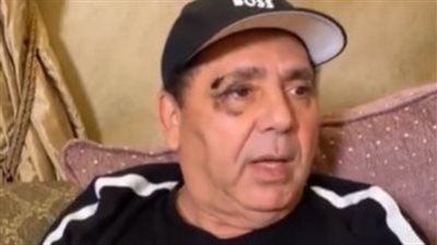 كنت مستحملها عشان بحبها.. زوج الفنانة علا غانم يروي تفاصيل تعديها هي ووالدتها عليه| بث مباشر 