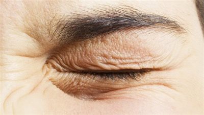 سبب رعشة العين كثيرًا.. أبرزها التعب والتصلب المتعدد