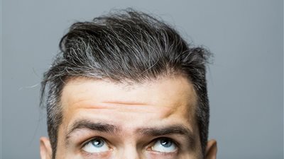 أبرزها ورم الدماغ.. بعض أسباب الشيب المبكر 